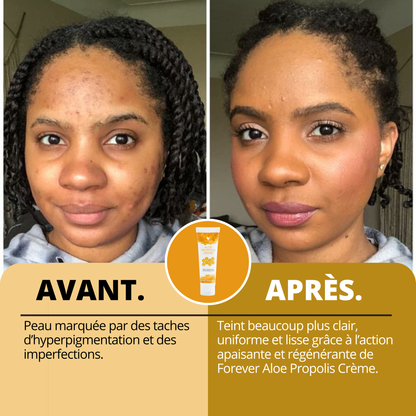 ALOE PROPOLIS CRÈME